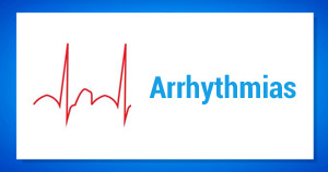 arrhythmias