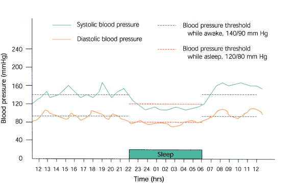 24-hour Ambulatory Blood Pressure (ABP) Monitoring