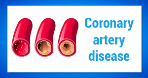 coronary-artery-disease