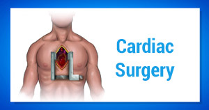 phcl-cardiac-surgery