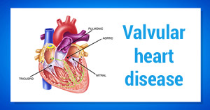 valvular-heart-disease